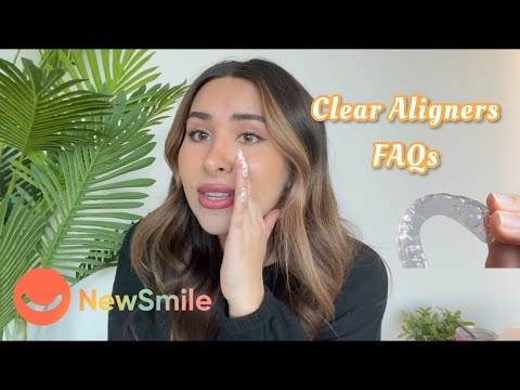 My clear aligner journey with New Smile (not SmileDirectClub) everything you need to know + FAQs