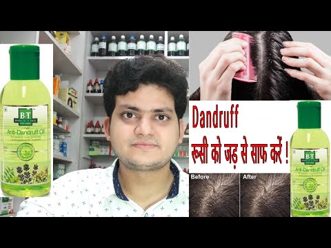 Overview of Anti-Dandruff Hair Oil