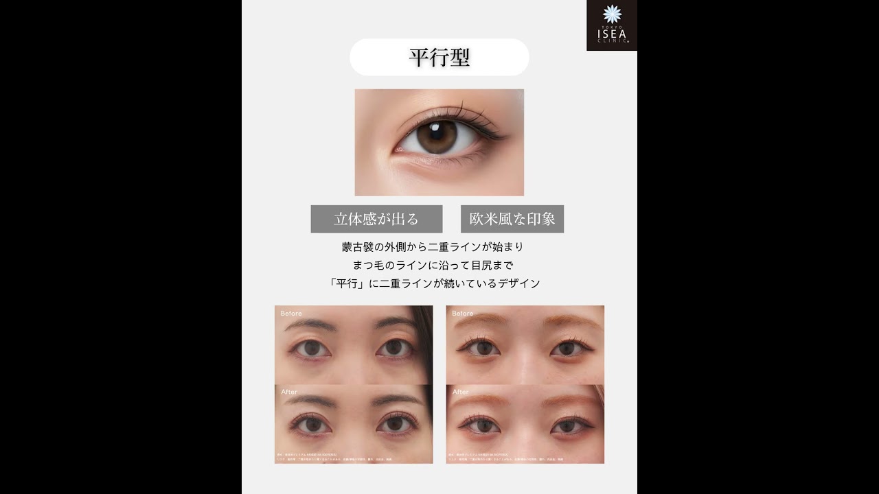 何番目の二重デザインが好き？