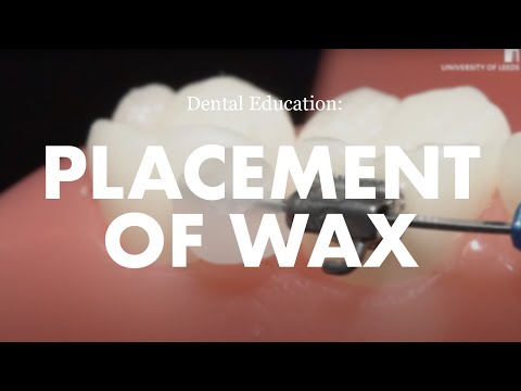 Orthodontic Emergencies: How to place wax on a fixed orthodontic appliance (brace)