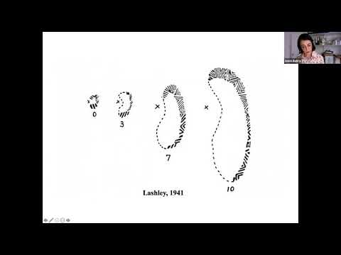 Managing Your Migraine – rare types of migraine