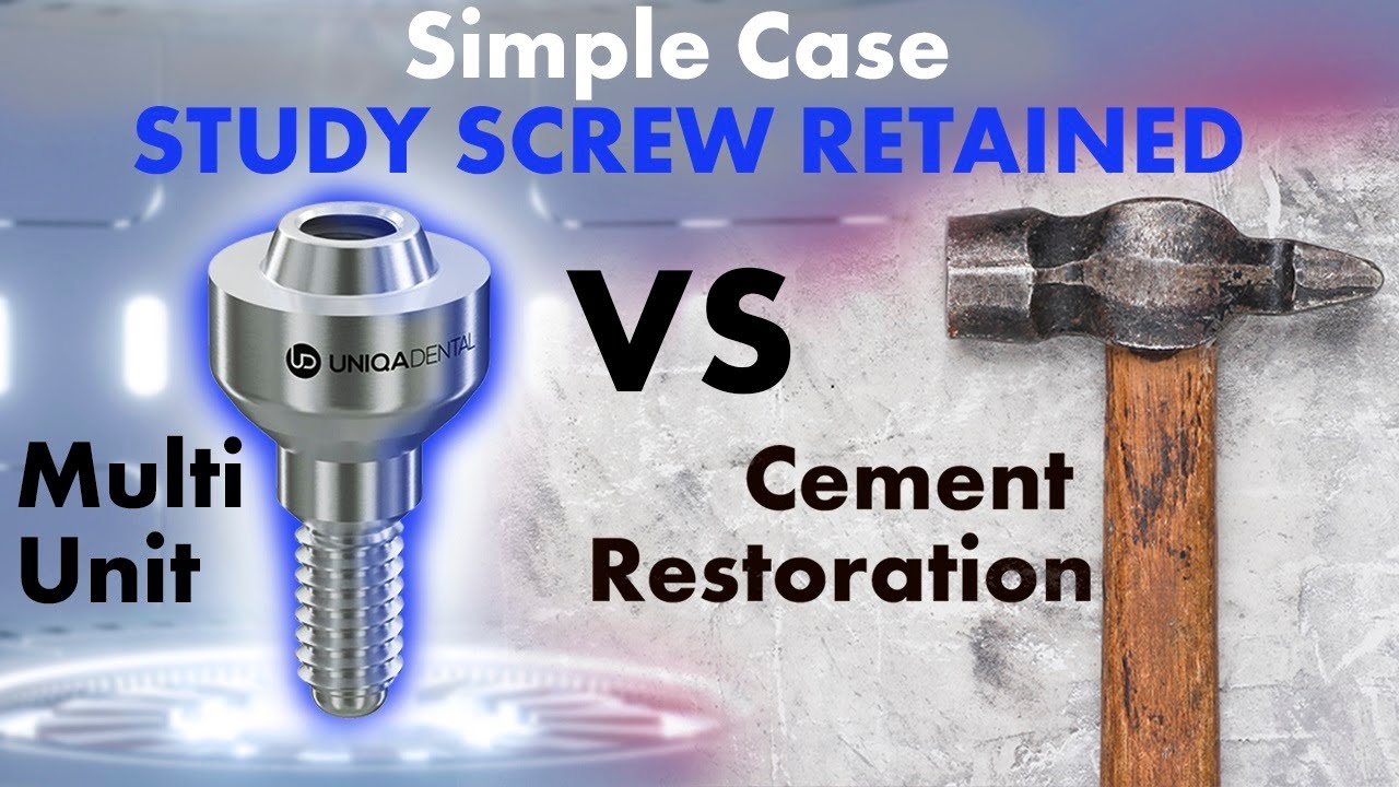 We typically recommend doing THIS with screw retained instead of cemented