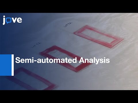 Semi-automated Analysis of Skeletal Muscle Morphology and Composition | Protocol Preview