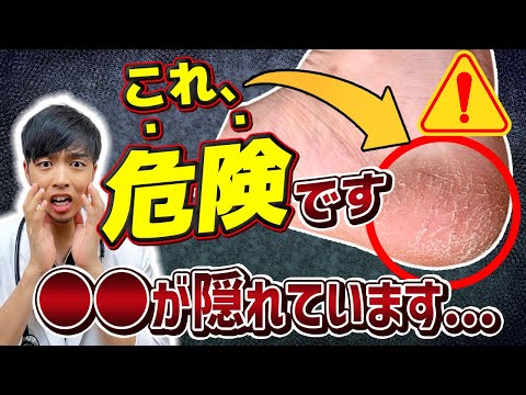 【要注意】踵のガサガサ、削らないで下さい。【内臓からのSOS】現役医師が伝えたい足でわかる病気の兆候【糖尿病/動脈硬化/水虫】