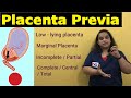 Placenta Previa | APH | Antepartum Hemorrhage-Types, Risk factors, Signs, Symptoms | Nursing Lecture