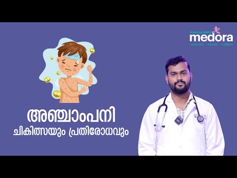 അഞ്ചാം പനി - ചികിത്സയും പ്രതിരോധവും | Measles | KIMS Alshifa Hospital