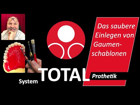 Modellation von Gaumenschablonen - #KallemachtProthesen