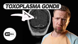 Selbstmord durch einen Parasiten? Toxoplasmose durch zwei Ärzte erklärt