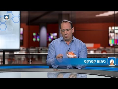 ניתוח קטרקט: המילון הרפואי