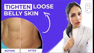 How To Tighten Loose Belly Skin after Pregnancy | How to Fix Sagging Belly Skin After Pregnancy