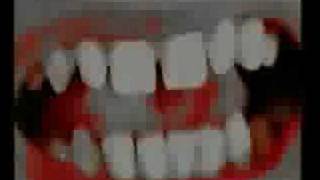 Sweetheart - Life Among Cannibals (music video)