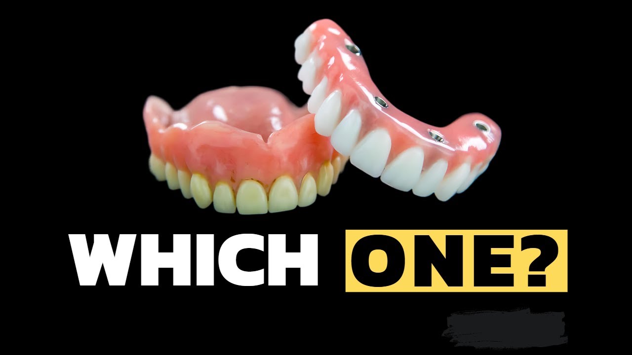 Dentures vs. Snap -in Dentures vs. ALL on 4 ®️ Bridge