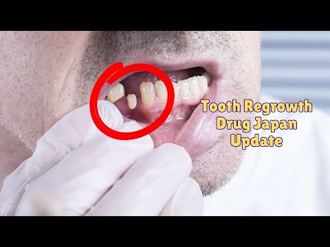 Update zu Medikamenten zur Zahnregeneration in Japan | Medizinisches Wunder