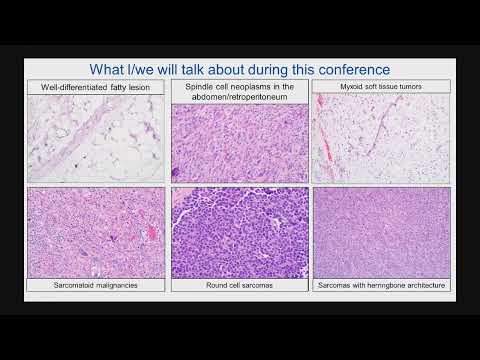 Lipomatous Tumors: Everything You Need to Know by Karen Joy Fritchie, M.D.