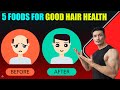 5 FOODS For Your HAIR HEALTH |PREVENT HAIR LOSS NATURALLY|