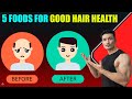 5 FOODS For Your HAIR HEALTH |PREVENT HAIR LOSS NATURALLY|