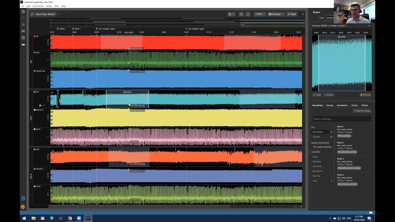 LabChart Lightning Introductory Series: Webinar 1 – Introduction to Lightning