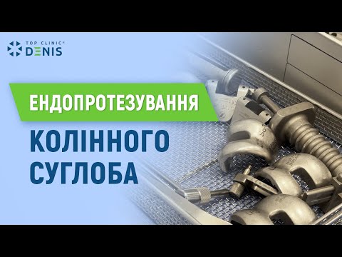 Эндопротезирование коленного сустава - TOP Clinic DENIS