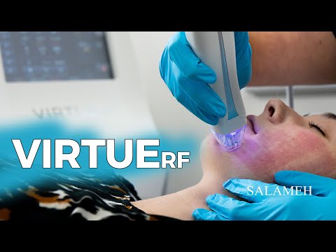 VIRTUE RF Microneedling Treatment Demonstration |...