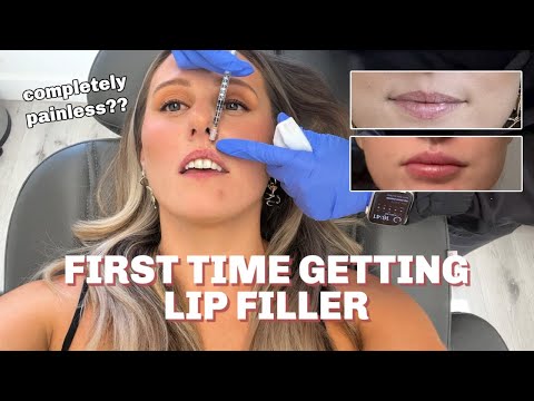 LIP FILLER FOR THE FIRST TIME | the entire process (half syringe + no pain)