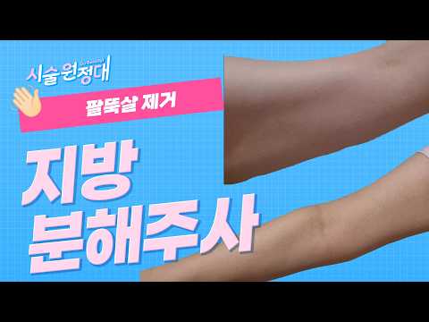 팔뚝살 그대로 리셋?