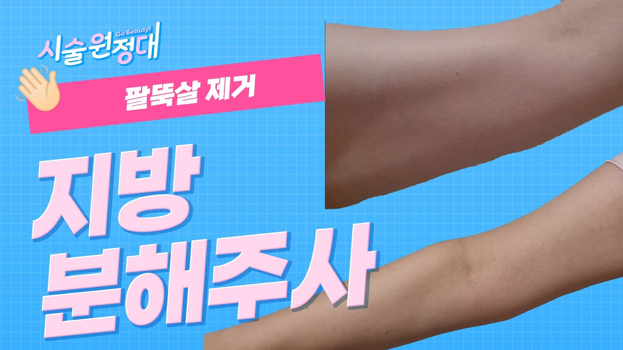 related_video_thumbnail