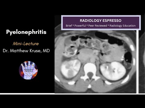 PYELONEPHRITIS: Mini Lecture, Dr. Matthew Kruse