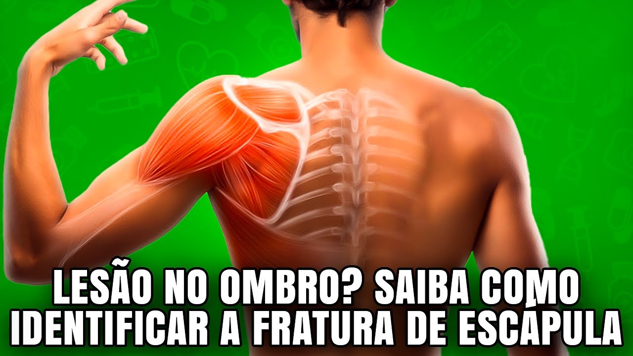 O Que Você Deve Saber sobre a Fratura de Escápula ou Omoplata