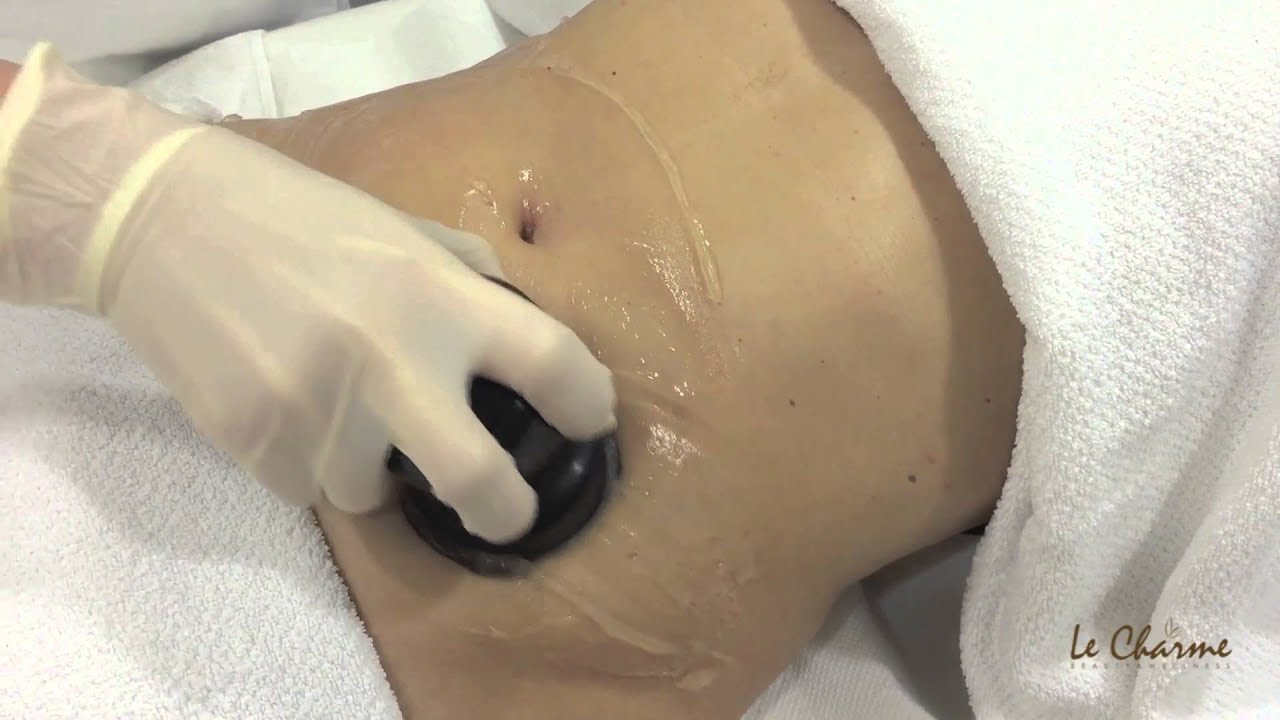 Radiofrequenza Pescara Le Charme