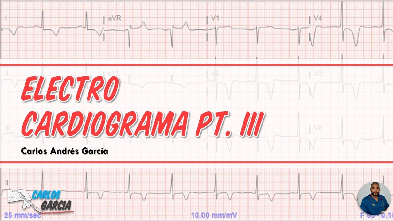 EKG Pt III - Calcular Frecuencia Cardíaca en 3 Métodos + EJERCICIOS