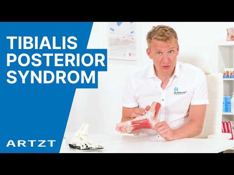 Posterior tibial tendonitis | Pain-free running with Dr. Marquardt | ARTZT