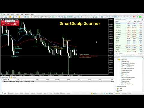 Video SmartScalp Scanner