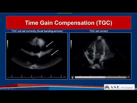 ASE Guidelines for Performing a Comprehensive Echo  in Adults Part 1