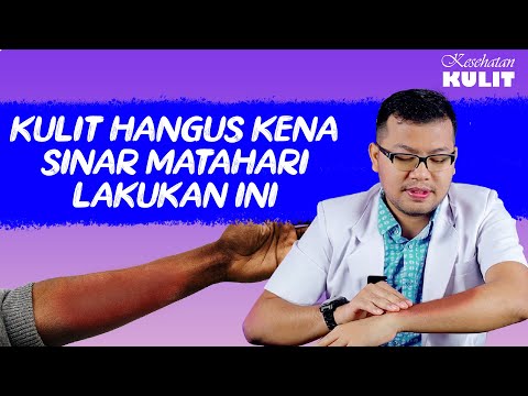 CARA ATASI KULIT TERBAKAR SINAR MATAHARI - DOKTER SADDAM ISMAIL