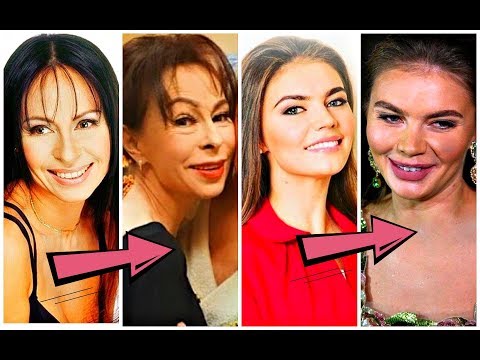 ЗВЁЗДЫ которые РЕЗКО ПОСТАРЕЛИ!