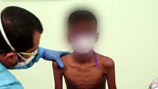 Placement of Hands for Chest Physiotherapy for Children with Cystic Fibrosis (Tamil)