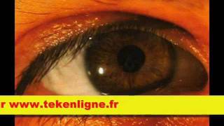 Epileptik Productions - EPKCDACT14 - Celsuis Resurrection