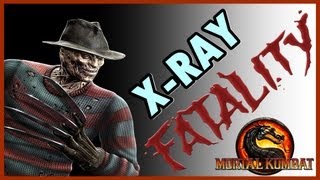 Mortal Kombat 9 Komplete Edition ( PS3 ) : Freddy Krueger  ( Fatalities + X-RAY )