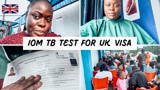 My IOM Tuberculosis Test Experience for UK 🇬🇧 Student Visa: Step by Step process