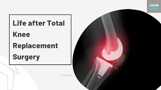 La vie après une arthroplastie totale du genou