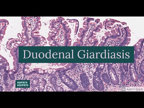 Giardia infection nhs