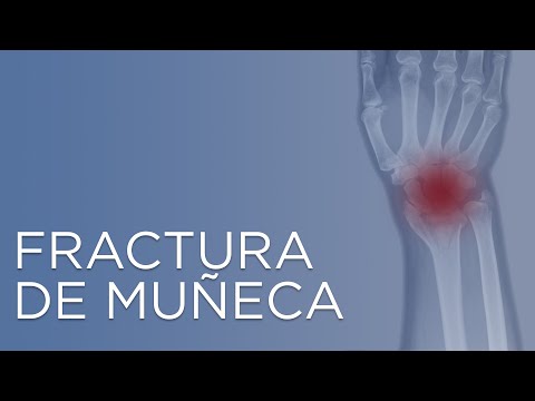 Fractura de muñeca  | Me he roto la muñeca | IQTRA
