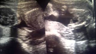 Deyker Daniel (sobrino)