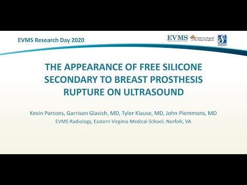 Thumbnail image of video presentation for The appearance of Free Silicone secondary to breast prosthesis rupture on ultrasound