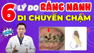 Răng Nanh Kéo Mãi Vẫn Không Dịch Chuyển | Nguyên Nhân Là Do Đâu?