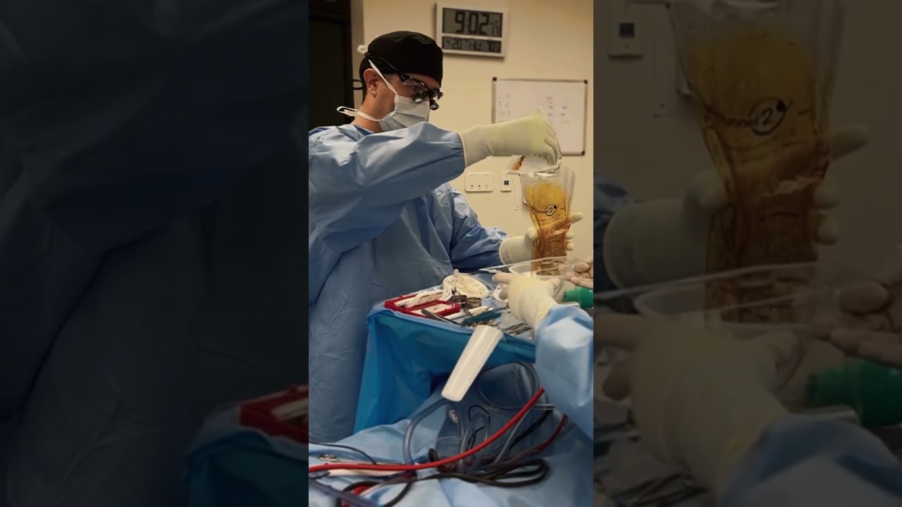 Breast lift with implants