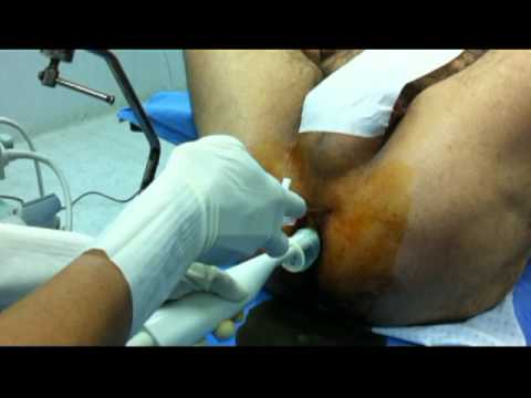 Prendendo analisi prostatica Prostata Massaggio Pompini