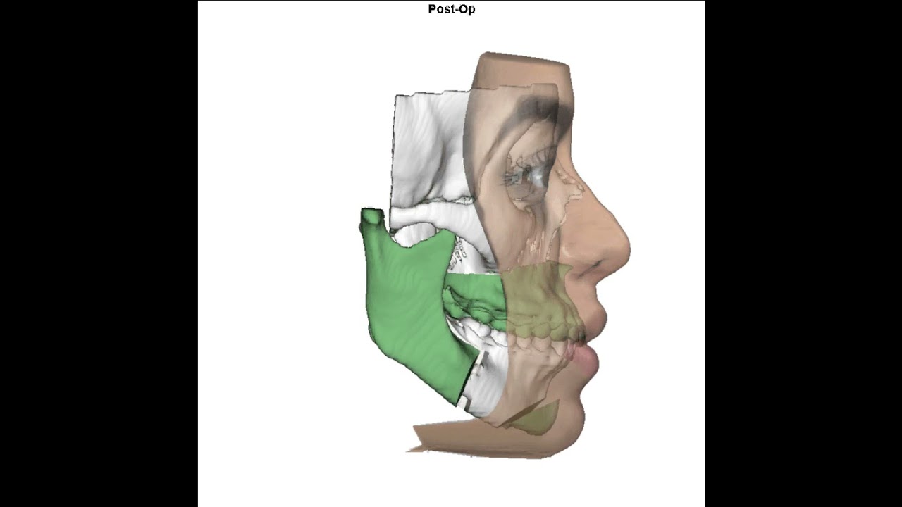 Carlos Alysson Aragão-56