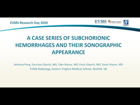 Thumbnail image of video presentation for A case series of subchorionic hemorrhages and their sonographic appearance