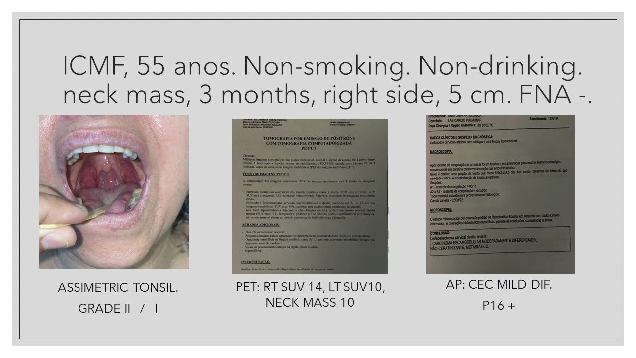 Adriano Santana Fonseca-13